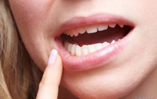 Retração gengival pode causar diastema?