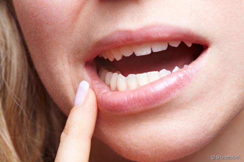 Retração gengival pode causar diastema?