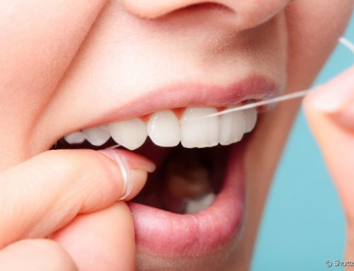 Fio dental: o correto é usar antes de escovar os dentes?